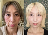 1年半で若返りを果たしたビフォーアフター／三浦敬子さん（@_keiko.beauty_8）提供